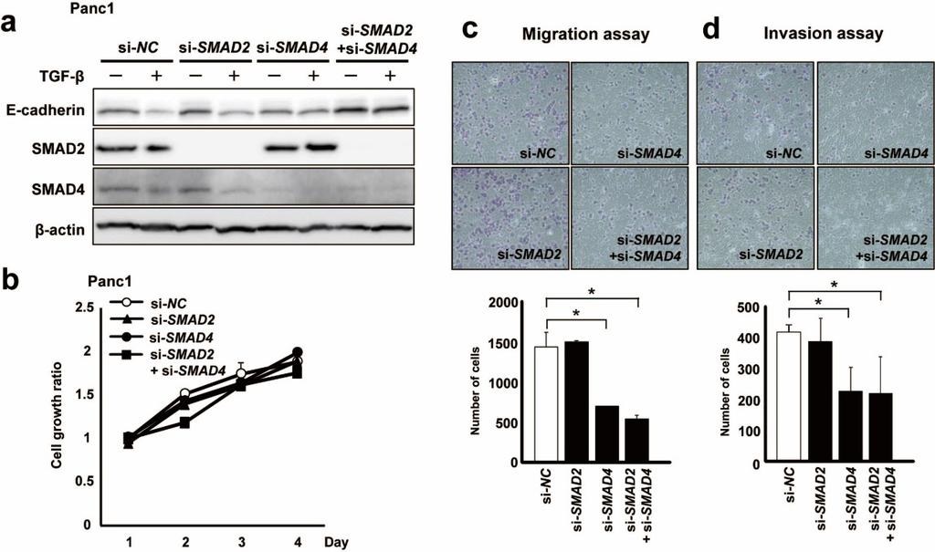 Supplementary Figure S6. Suppression of SMADs reduces the effect of TGF-β.