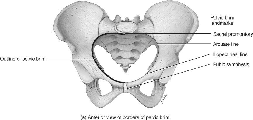 pubis separates false from true pelvis false