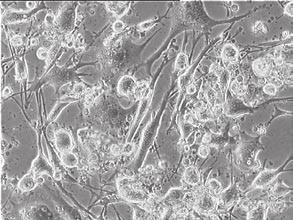 Fibroblast Growth Factors regulate stromal cells and hematopoietic cells in vitro many weeks.