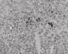 Interleukin-1 increases fetal liver hematopoietic progenitor cells A B Figure 1.