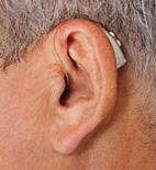 Motion can fit any ear, any age group, and any hearing impairment; it is fully-featured, hassle-free, and reliable.