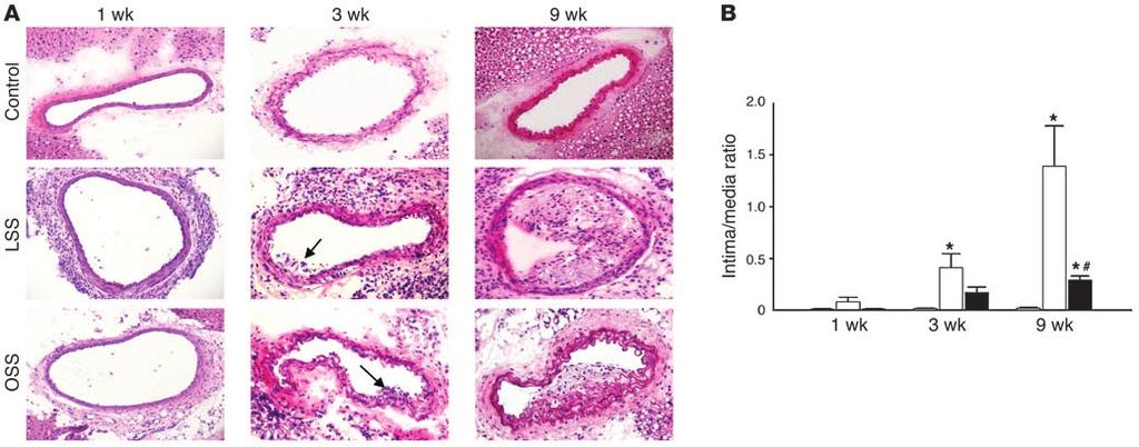 Figure 1 Representative H&E-stained cross-sections of murine carotid arteries at different time points after cast placement in mice on a Western diet.