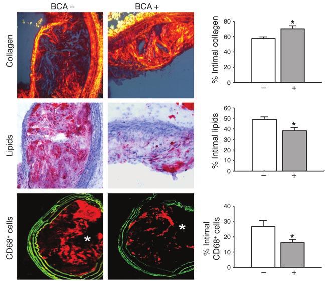 Figure 9 Fractalkine function was inhibited during atherosclerosis development in the BCAs in apoe / mice on a Western diet by administration of a neutralizing antibody from week 6 until week 9.