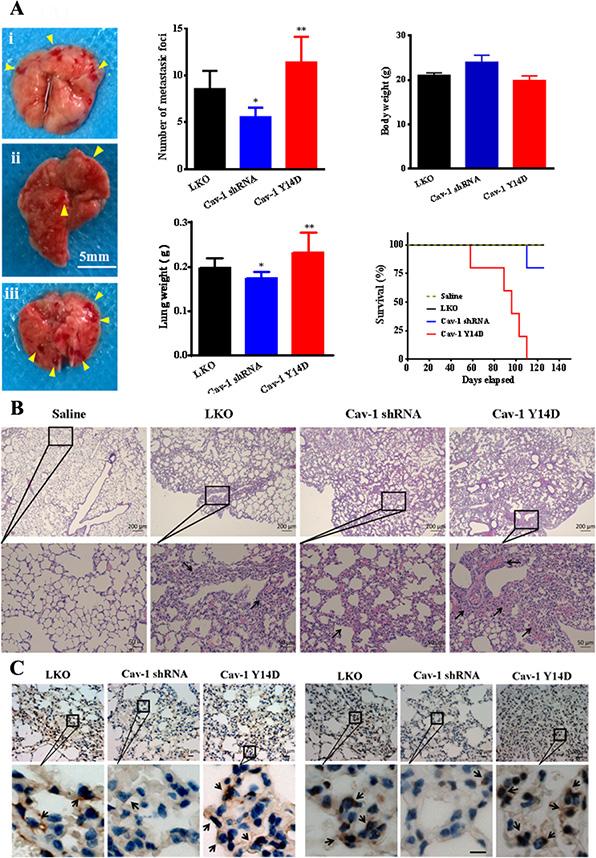Figure 13: Cav-1 is associated with tumor invasiveness and metastasis in vivo.