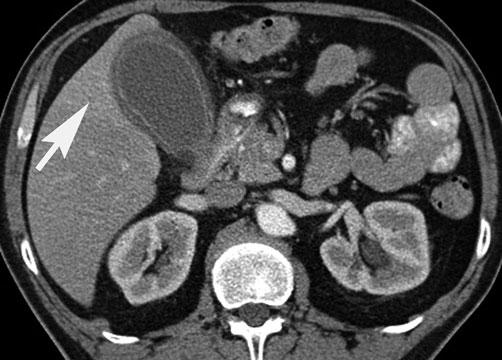 c, d Contrast-enhanced computed tomography (CT) with intrave nou sly and orally administered contrast