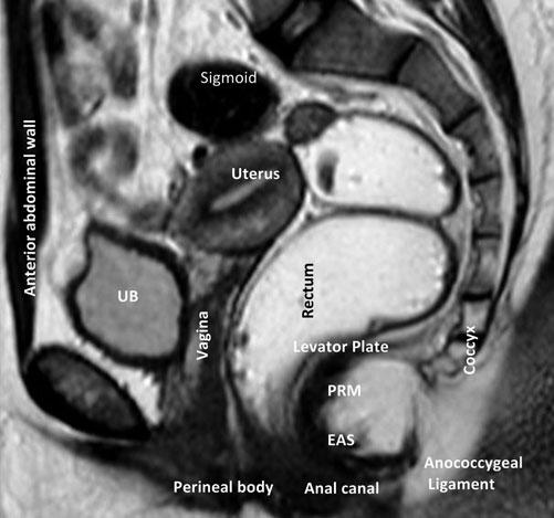 least the basic anatomy of the pelvic floor and PFD patho - physiology.