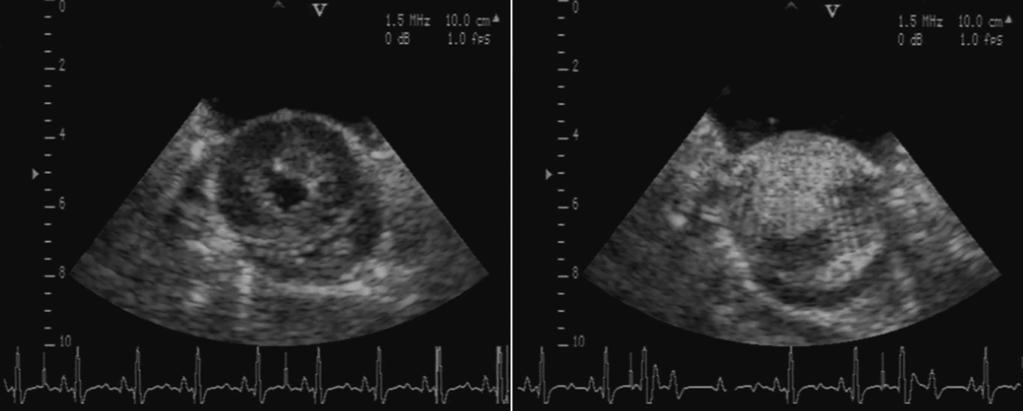 The safe use of contrast-enhanced diagnostic ultrasound 8 Figure 8.2. Ultrasound images for an open-chest canine model of MCE with intermittent imaging each 4 beats at end systole.