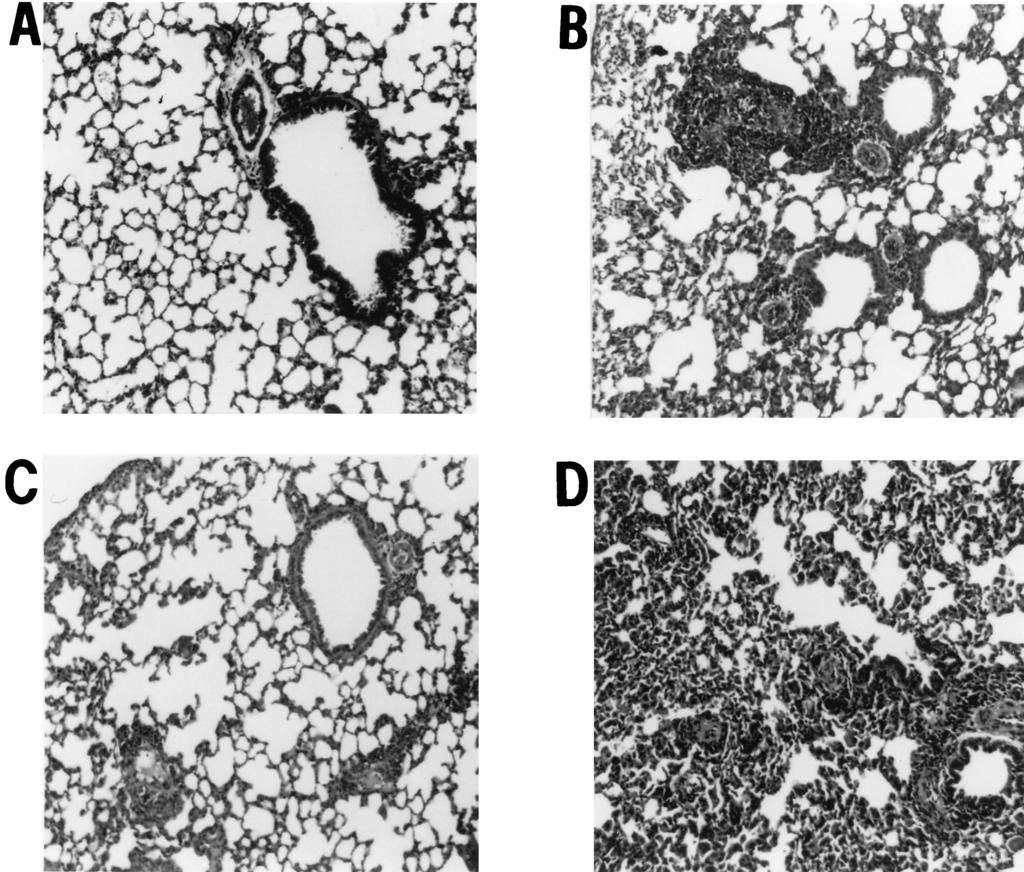 VOL. 69, 2001 B. MALAYI-INDUCED LUNG PATHOLOGY 1465 FIG. 2. Lung histopathology in C57BL/6, IL-4 /, and IFN- / mice. C57BL/6, IL-4 /, and IFN- / mice were immunized and injected i.v.