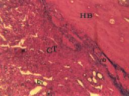 Octacalcium phosphate & bone matrix gelatin in bone regeneration Fig 1: Photomicrograph of untreated control group on day 21; a narrow margin of new bone (NB) attached to the host bone (HB) is