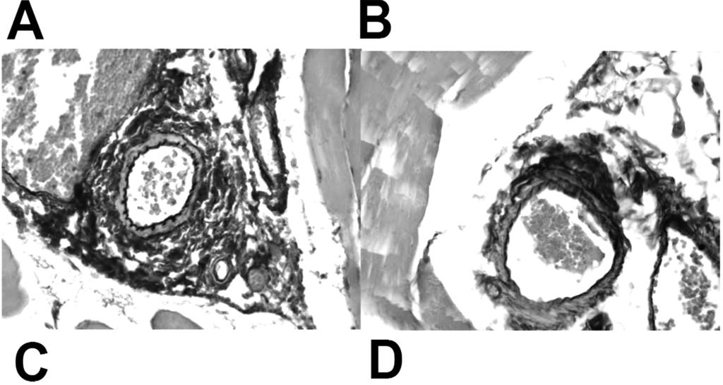 4 Figure 1 Representative histomorphologic pictures of MRL/lpr (upper panels) and MRL (lower panels) gracilis muscle arterioles.