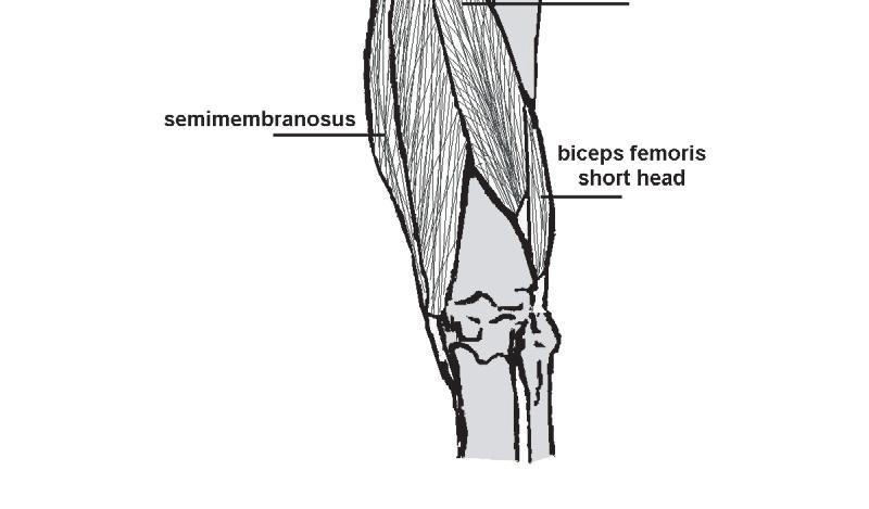 Such movements place the hamstrings in a position of extreme stretch, with injuries most commonly presenting in the semimembranosus and its proximal free tendon (as opposed to the intramuscular