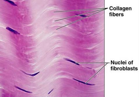 Exercise B: Connective Tissues Dense (fibrous) connective tissue Location tendons