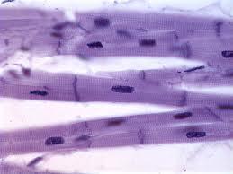 Exercise C: Muscle Tissues Cardiac muscle Branched, uninucleate cells with striations Location walls