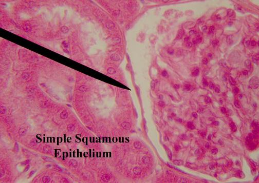 There are several types of simple epithelium in the body.