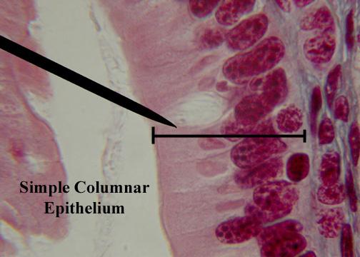 Simple squamous epithelium is used in a number of places in the body where