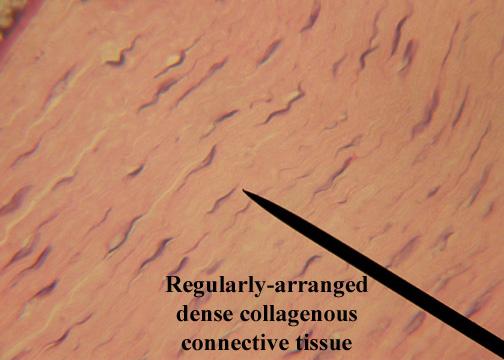 Pseudostratified epithelium is a single layer of tissue cells that gives a false appearance of multiple layers.