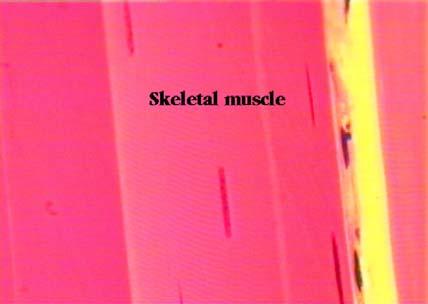 Nervous Tissue The final type of basic tissue is nervous tissue.