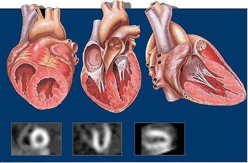 Imaging of cardiaca