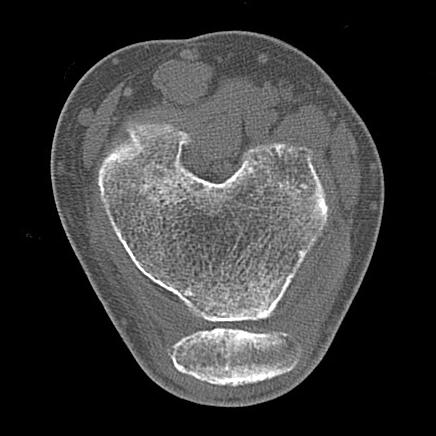 Case 1 A 16-year-old female patient was admitted to our clinic with symptoms of persistent instability.
