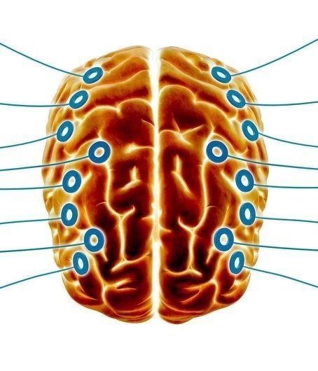 Introduction to the EEG technique Part 1: neural origins