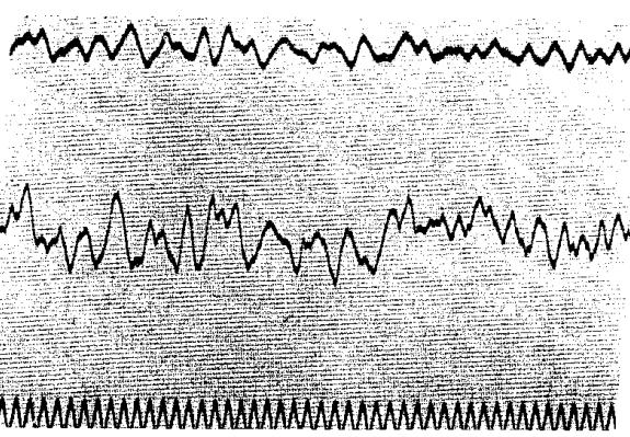records brain potentials from cortex 1929 Berger records electrical activity from the scalp