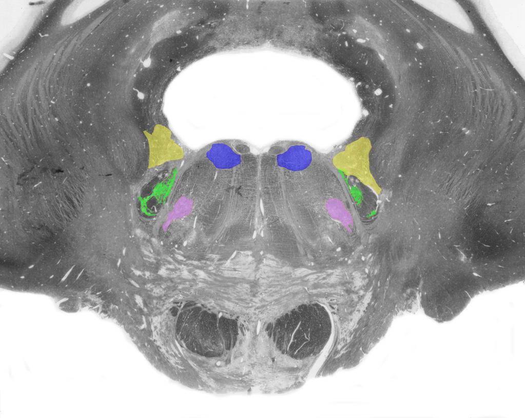 Cranial Nerve Nuclei Vestibular nuclei Abducens nucleus Spinal trigeminal nucleus