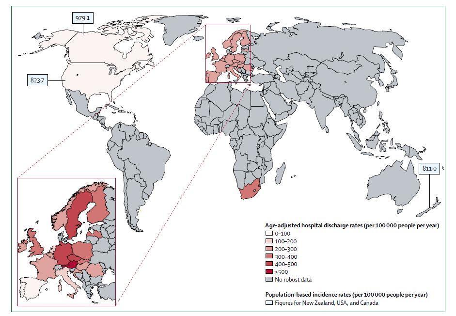 Worldwide TBI Incidence By Age-standardized Rates Worldwide: 50