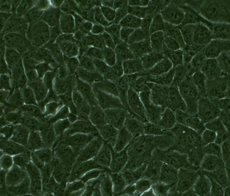 Figure 2.2- Phase contrast image of RT-112 cells in vitro (40X objective) 2.2- Cell Culture All the reagents for cell culture were obtained from Gibco (Grand Island, NY) unless otherwise stated.