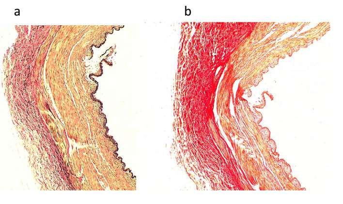 Figure 2.5. Representative histological images of the porcine renal artery wall viewed at 40x magnification.