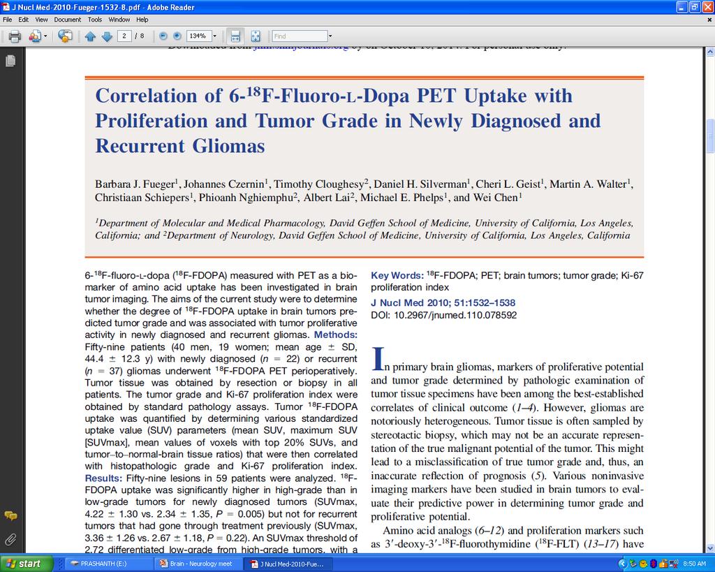 Conclusion: 18F-FDOPA uptake is significantly higher in high-grade than in low-grade tumors in newly diagnosed but not recurrent tumors that had been treated previously.