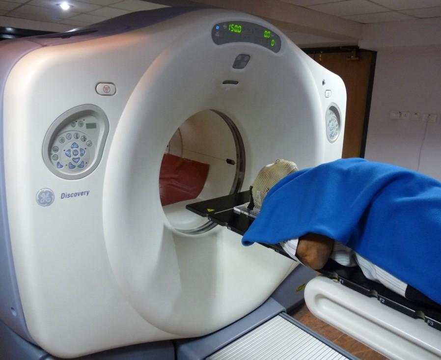 Simulation [CT,PET CT] Image acquisition C11 MET : 15 min Plan and therapy set up finished