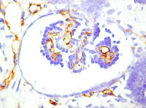CD34 expression in the lung (), kidney (), hert