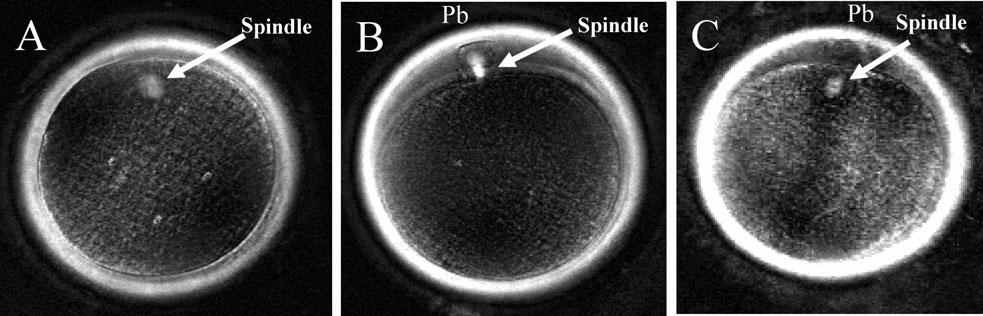 Optimal ICSI timing after in vitro maturation of oocytes Figure 1: Bi-refringent spindles in living human oocytes imaged at maturation stage with the Polscope following IVM (A) MI oocyte had the