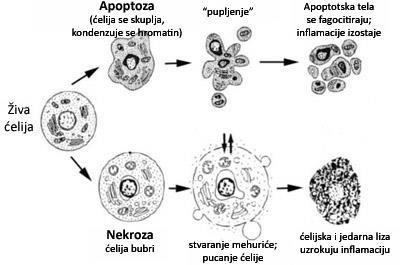 Slika 6. Apoptoza podrazumeva skupljanje ćelije, kondenzaciju hromatina, potom fragmentaciju jedra i ćelije pri čemu ne dolazi do narušavanja integriteta membrane.
