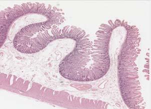 specific segments/regions: duodenum, jejunum, and ileum Look for: (1) villi with fairly uniform appearance; (2) simple columnar epithelium with goblet cells; (3) muscularis mucosae layer of mucosa;
