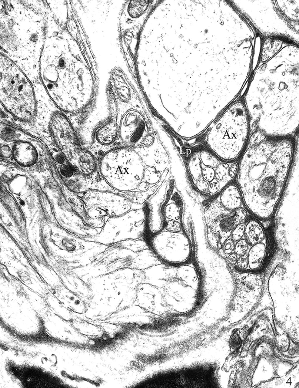 Małgorzata Bruska et al., Human foetal hypogastric nerves Figure 4. The right hypogastric nerve in a human foetus at 23 weeks; Ax axon, Lp lemmocyte process. 42000.