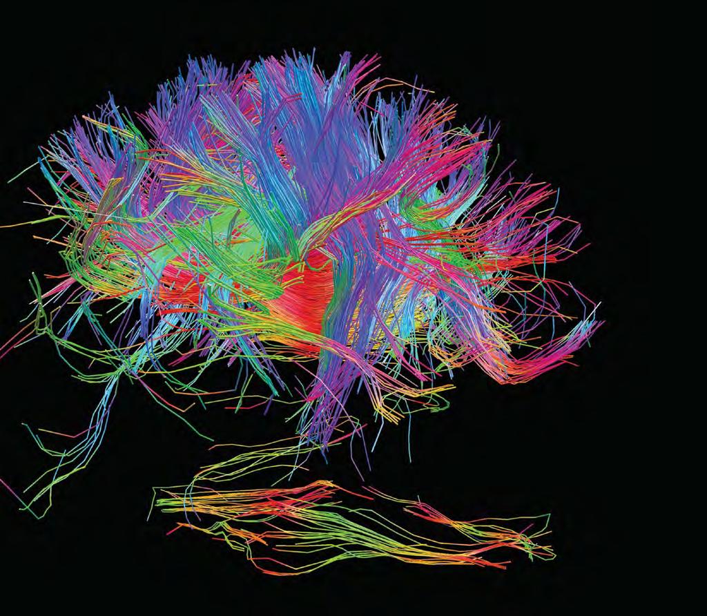 White-matter fiber architecture of the brain, as measured by diffusion spectral imaging (DSI).