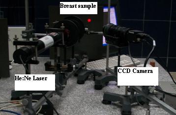 The camera interfaced to computer, for analysis and digital image processing.