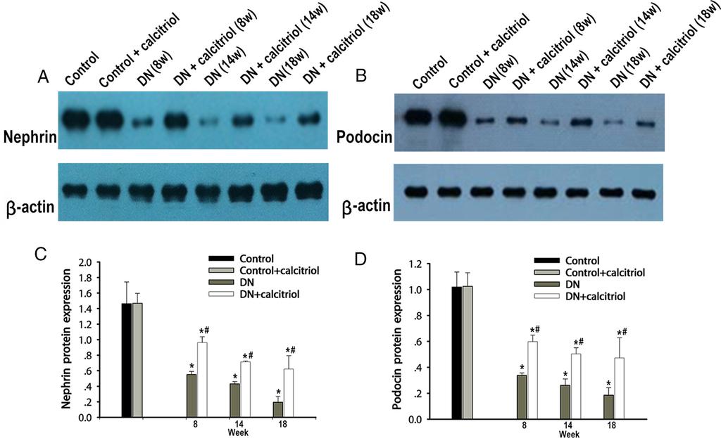 4944 Zhang et al Vitamin D Regulates Macrophage to Protect Podocyte Endocrinology, December 2014, 155(12):4939 4950 Figure 2.