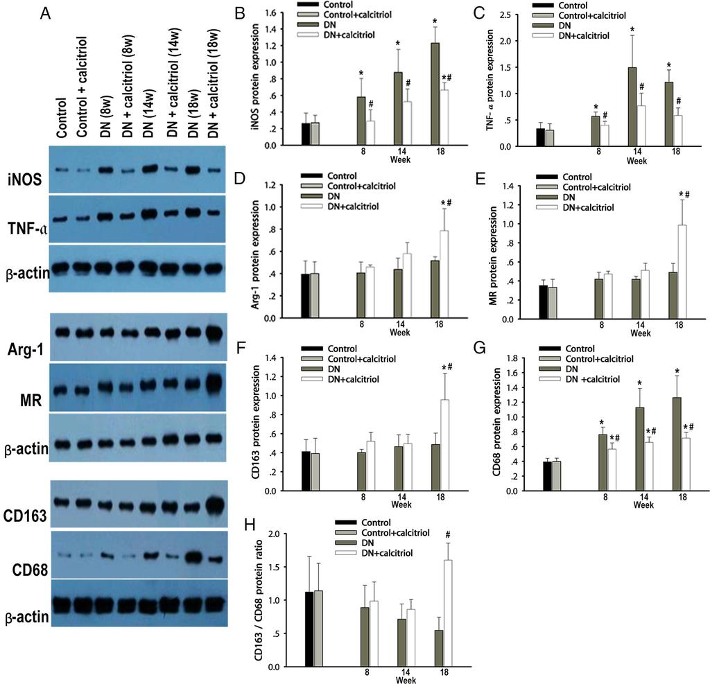 4946 Zhang et al Vitamin D Regulates Macrophage to Protect Podocyte Endocrinology, December 2014, 155(12):4939 4950 Figure 4.