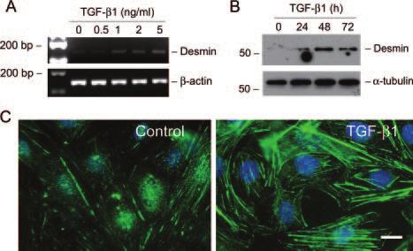 Results TGF- 1 Suppresses Epithelial P-Cadherin and ZO-1 Expression in Podocytes Podocyte slit diaphragm, a modified P-cadherin-containing adherens junction, is an essential component of the