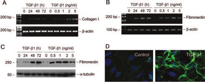 Podocyte EMT 303 Figure 5. TGF- 1 induces interstitial matrix type I collagen and fibronectin expression in podocytes.