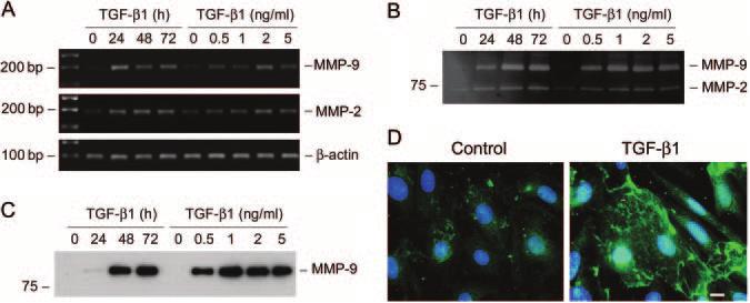 C: Western blot analysis shows that TGF- 1 induced fibronectin protein expression in a time- and dose-dependent manner.