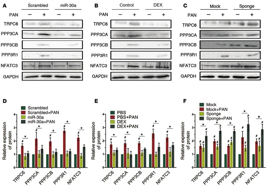 The Journal of Clinical Investigation Figure 3. mir-30s regulate the expression of TRPC6, PPP3CA, PPP3CB, PPP3R1, and NFATC3 proteins in cultured human podocytes.