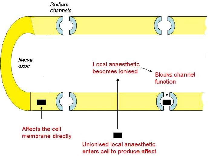 Local anaesthetics as isomers Local anaesthetics may also be considered in terms of their stereoisomerism.