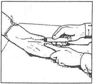 (3) STEP 3: Perform the puncture. (a) Replace the tourniquet. make a fist.
