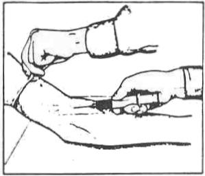 Figure 2-1e. Aspirate the blood. (5) STEP 5: Release the tourniquet and ask the patient to relax the fist. Figure 2-1f. Remove the tourniquet.