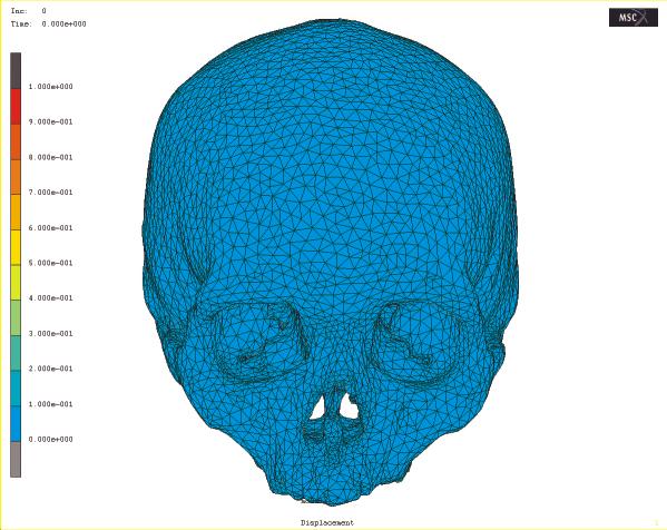 Head impacts & bicycle helmet design Detailed modeling of skull vibration during impact Skull mode shape visualization Courtesy of E.