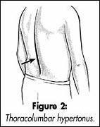 Palpation of passive joint mobility