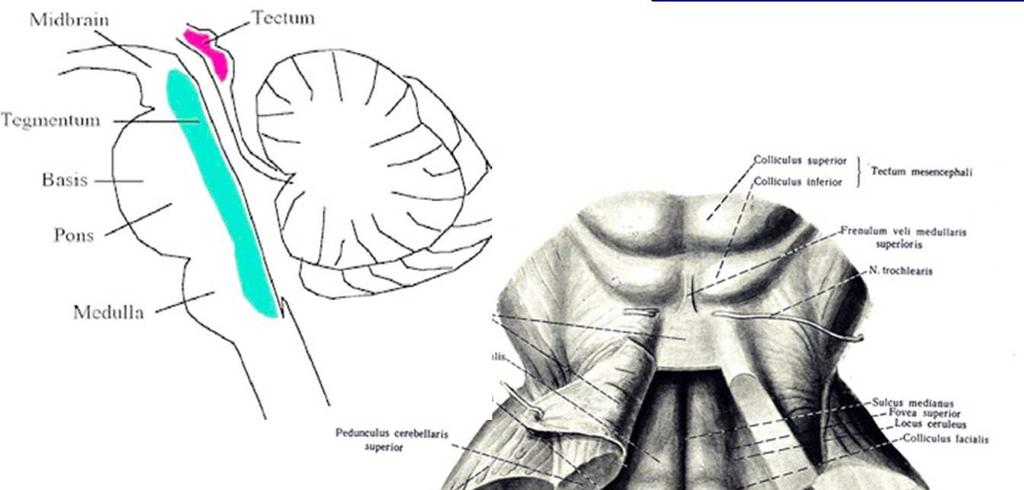 Pons dorsal view and tectum Pons tectum = superior medullary velum tegmentum = dorsal